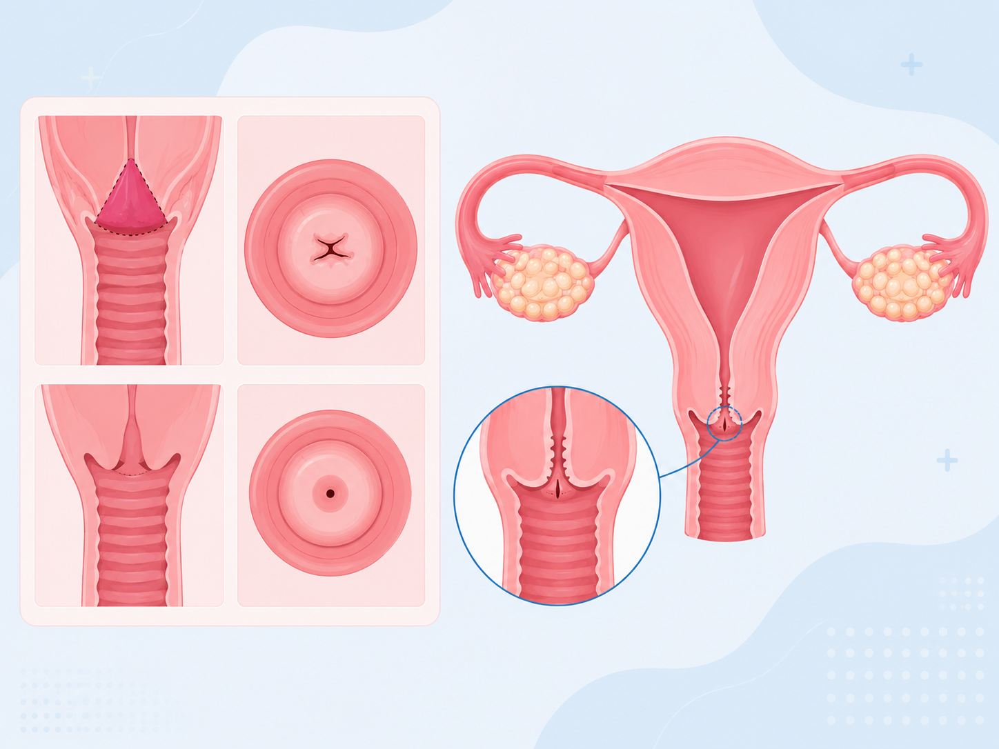 Per Vaginal Examination in Pregnancy: Why It Is Done During the 8th Month