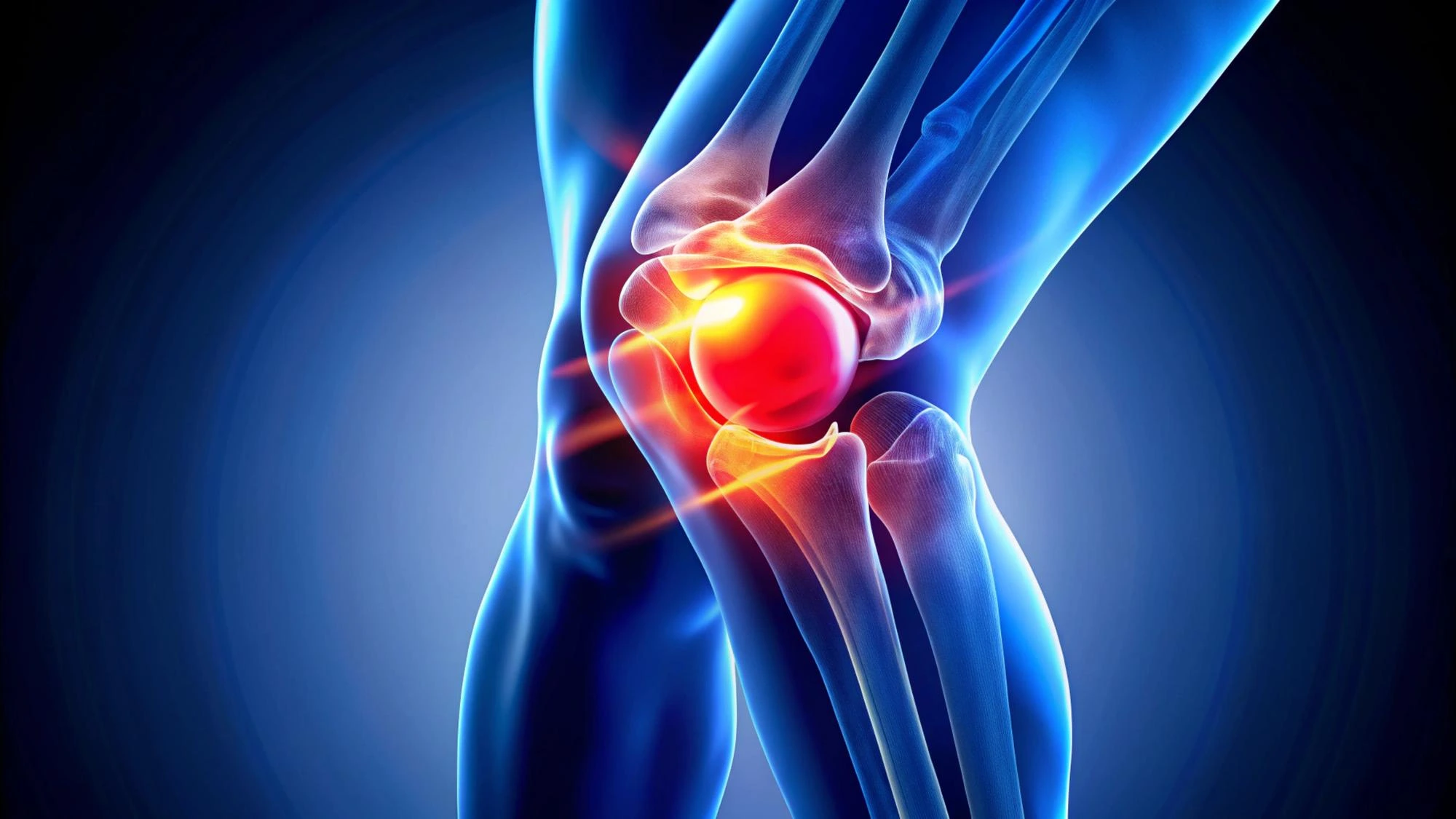 Joint Replacement Surgery: Why Choose Chennai Super Speciality Orthopedics Joint Replacement Surgery: Why Choose Chennai Super Speciality Orthopedics